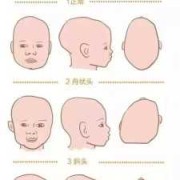 怀孕小排畸是前额凸起是怎么回事,胎儿头骨大怎么回事