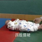 胎儿脑瘫会胎动吗,脑瘫胎儿时期可以筛查出来么