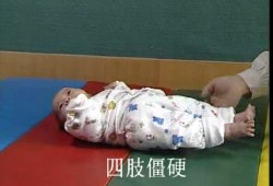 胎儿脑瘫会胎动吗,脑瘫胎儿时期可以筛查出来么
