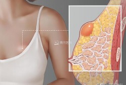 孕期胸部有硬块（孕期乳房有硬块不疼怎么办）