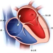 卵圆孔未闭怎么办？是不是新生儿都是闭合的,胎儿卵圆孔提前闭合与妊娠结局的临床分析