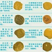 胎儿排便（十个月宝宝正常的大便是什么样的）