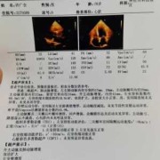 孕期心脏彩超什么时候做（孕期心脏彩超什么时候做最好）