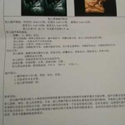 胎儿偏小一周是什么原因引起的,为什么胎儿会偏小一周
