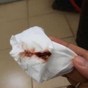 孕期四十天出血（有没有怀孕40天出血像月经一样的）