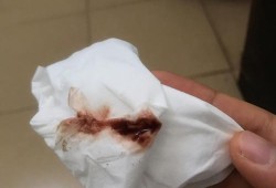 孕期四十天出血（有没有怀孕40天出血像月经一样的）