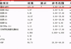 孕期甲胎蛋白参考值（甲胎蛋白值多少算正常）