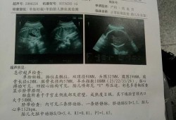 胎儿偏小3周问题大吗（胎儿偏小3周问题大吗正常吗）