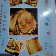 四维彩超怎么看胎儿是男是女呢（四维彩超怎么看胎儿是男是女呢数据）