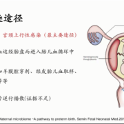 胎儿宫内感染的原因（胎儿宫内感染的原因）