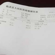 怀孕五周TSH偏高T3T4正常对宝宝有影响吗,孕期甲减标准值