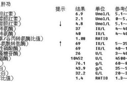 孕期转氨酶升高（孕期转氨酶升高怎么办）