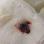 孕期鼻涕有血丝（孕期鼻涕有血丝怎么回事）