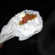 孕妇拉的屎是黑色的，这是怎么回事呢,怀孕期间大便是黑色的正常吗