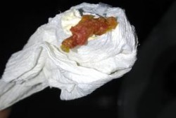 孕妇拉的屎是黑色的，这是怎么回事呢,怀孕期间大便是黑色的正常吗