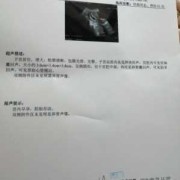 孕期彩超图（孕期彩超图片）