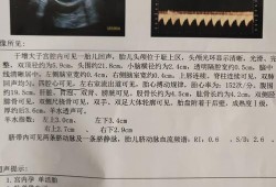 胎儿双顶径小吃什么补（胎儿双顶径小吃什么补得快）