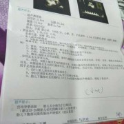 胎儿部分肠管回声增强（下腹部肠管回声增强怎么办）