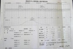 孕期心跳120（胎儿心率快怎么回事）