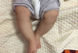 胎儿头偏大腿偏短（胎儿头偏大腿偏短是什么原因）