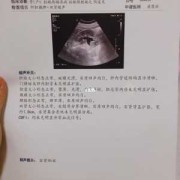 孕晚期如果查出肾不好对宝宝有影响吗,胎儿肾不好是什么原因引起的