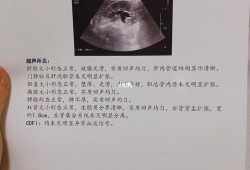 孕晚期如果查出肾不好对宝宝有影响吗,胎儿肾不好是什么原因引起的