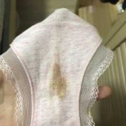 孕期为什么会流血（孕期为什么会流血褐色）