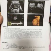 我家孩子43天做了一个脑部彩超。左侧脉络丛小囊肿，怎么办,胎儿左下腹囊肿怎么办啊