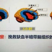 儿童缺血灶怎么办,胎儿脑缺血是什么导致的