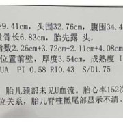 医生摸的胎儿体重准吗（医生摸的胎儿体重准吗怎么看）