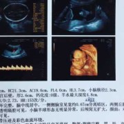 二十四周胎儿（孕24周侧脑室宽度标准）