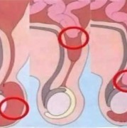 胎儿鼓包是男孩女孩（胎儿鼓包是男孩女孩吗）