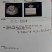 婴儿消化道畸形B超可以检查出来吗,消化道畸形胎儿的表现有哪些