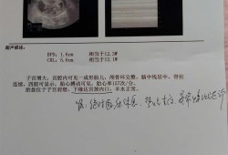 婴儿消化道畸形B超可以检查出来吗,消化道畸形胎儿的表现有哪些