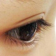 孕期眼睛黄（孕妇眼睛肿了怎么办？孕期眼睛肿了吃什么消肿好呢）