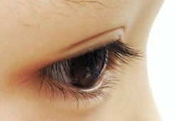 孕期眼睛黄（孕妇眼睛肿了怎么办？孕期眼睛肿了吃什么消肿好呢）