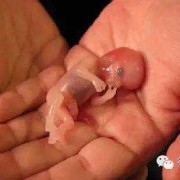 孕妇死亡胎儿会死吗（孕妇死亡胎儿会死吗视频）