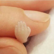 胎儿多大需要引产（怀孕超过14周能引产吗）