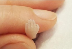 胎儿多大需要引产（怀孕超过14周能引产吗）