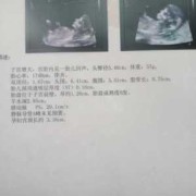 12周胎儿头臀径标准,nt检查挂什么科