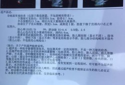胎儿心积水（胎儿心积水）