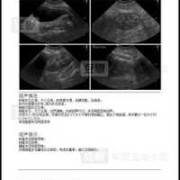 胎儿多囊肾还能要吗（女朋友有家族遗传病，多囊肾，我该怎么办？要不要和她结婚）