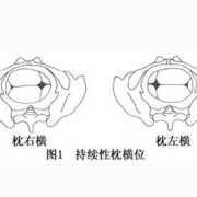 39周胎位头位(左枕横位)不晓得是什么意思,30周胎儿横位还能转过来吗