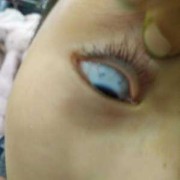 胎儿没眼球（宝宝白眼球里面有点发灰，是什么原因）