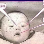胎儿眼距小（胎儿眼距小有什么危害）