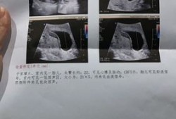 怀孕九周胎儿有多大（孕9周如何判断胎儿正常，要做什么检查）