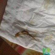 孕期有点血（孕期有点血色分泌物怎么回事）
