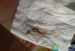 孕期有点血（孕期有点血色分泌物怎么回事）