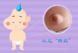 脐疝对宝宝有什么影响吗,胎儿脐疝属于畸形吗