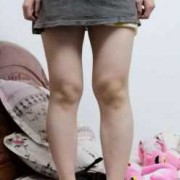 孕期腿长胖（婴儿腿一边瘦一边胖）